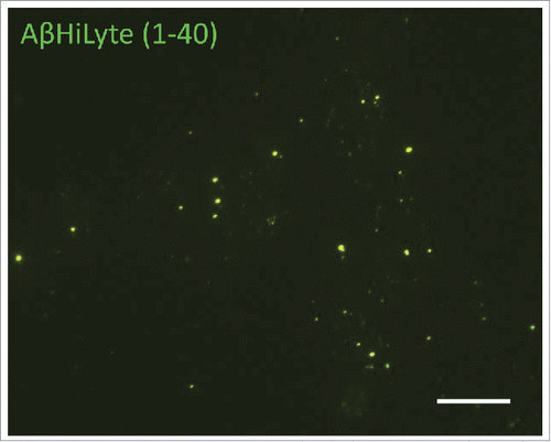 Figure 3. Exogenous Aβ (1-40) HiLyte in HBMEC-derived ECV. HBMEC were exposed to 100 nM Aβ (1-40) HiLyte for 48 h, followed by ECV isolation from cell culture media. Aβ (1-40) HiLyte (green fluorescence) in the isolated ECV was visualized by fluorescence microscopy. The images show the green fluorescent Aβ (1-40) HiLyte associated with ECV of different sizes. Scale bar: 20 μm.