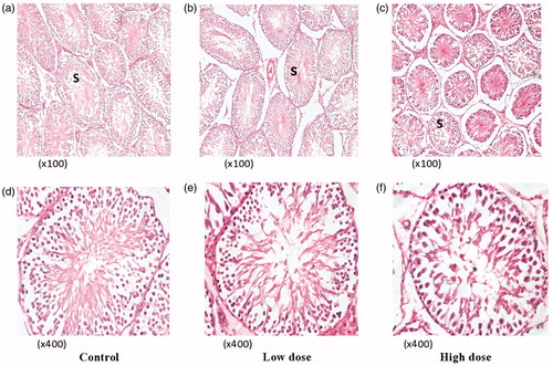 Figure 4. Photomicrographs of the testes (both C and P. niruri treated groups). (a, b and c) are sections of the testes of the C, LD and HD groups, respectively, at a lower magnification of ×100 (H&E), while (d, e and f) are higher magnifications (×400 H&E) in the same order. The extract affected the seminiferous tubules (s), reducing their diameters as the dose increased from 50 (4b) to 500 mg/kg b.wt. (4c) with an apparent shrinkage, suggestive of fluid accumulation in the testes.