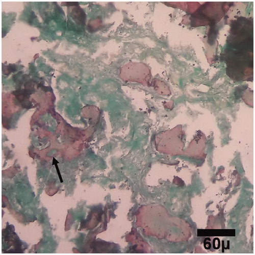 Figure 5. Microscopic section from the healing site of HA-treated group on day 30 of healing. A few primary bones (arrow) are being to produce (trichrom ×100).