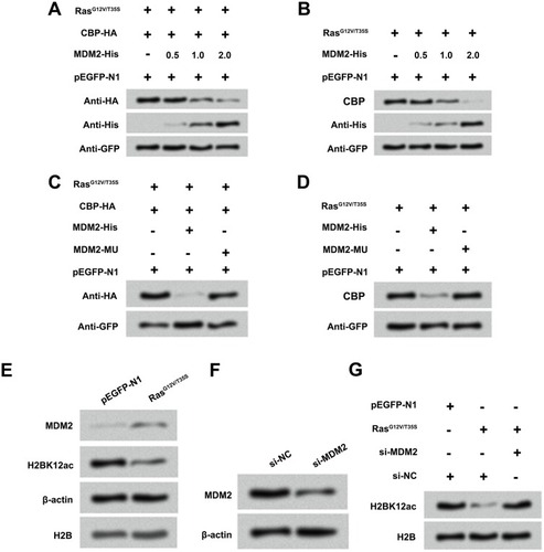 Figure 6 Ras-ERK1/2 activation-induced degradation of CBP is mediated by MDM2. (A and B) MG-63 cells were co-transfected with CBP-HA, RasG12V/T35S, pEGFP-N1 plasmids and increasing amounts of MDM2-His plasmid (0.5, 1 and 2 µg), and the protein levels of CBP and MDM2 were assessed by Western blot assay. (C and D) A mutation in MDM2 (MDM2-MU), and the above plasmids were transfected into MG-63 cells, and the protein levels of CBP were analyzed by Western blot assay. (E) Protein levels of MDM2 and H2BK12ac in pEGFP-N1 and RasG12V/T35S transfected cells were examined by Western blot assay. (F) Protein levels of MDM2 in si-NC and si-MDM2 transfected cells were examined by Western blot assay. (G) Protein level of H2BK12ac in pEGFP-N1, RasG12V/T35S, si-NC and si-MDM2 was examined by Western blot assay.Abbreviations: H2BK12ac, histone H2B acetylated on lysine 12; ERK, extracellular signal-regulated kinase; MDM2, murine double minute 2; CBP, CREB binding protein.