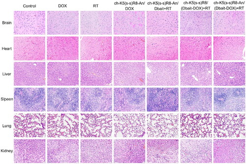 Figure 7. Representative histological micrographs of main organs following the administration of saline, free DOX, RT, ch-K5(s-s)R8-An/DOX, ch-K5(s-s)R8-An/Dbait + RT, ch-K5(s-s)R8/(Dbait-DOX) + RT, ch-K5(s-s)R8-An/(Dbait-DOX) + RT. Scale bar is 100 µm.