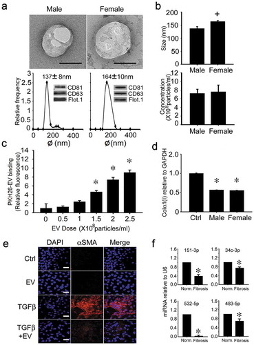 Figure 9. Characterization and actions of human serum EVs. (a) TEM (upper panel; scale bar: 100 nm; representative images are shown), NTA (lower panel) and Western blot analysis (lower panel, inset) of EVs purified by ultracentrifugation of serum of normal male or female human blood. Data are from individual donors and are representative of each gender (n = 9 males, 9 females). (b) size (upper panel) and concentration (lower panel) of serum EVs from individual NTA analysis of all human donors (n = 18), with data grouped by gender (n = 9 per group). (c) LX-2 cells were incubated for 16 h with purified human serum EVs that had been labelled with PKH26 dye. Cell-associated PKH26 was determined by fluorescence measurement in cell lysates. n = 3 independent experiments performed in triplicate. *P < 0.01 versus no treatment. (d) suppression of collagen α1(I) gene expression in LX-2 cells that were serum-starved for 24 h and then treated for 24 h with 5 × 108 particles/ml pooled human serum EVs from healthy male or female donors. n = 9 independent experiments performed in triplicate. *P < 0.01 versus control. (e) αSMA IHC in LX-2 cells that were serum-starved for 24 h and then incubated in the presence of TGFβ for 36 h, with or without human serum EVs for the last 24 h. Images are representative of five independent experiments. Scale bar: 20 μm (f) RT-PCR of serum EV miRs in control subjects versus F3/F4 fibrosis patients (*P < 0.05).