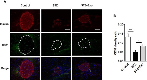 Figure 6 Effect of exosomes (Exo) on endothelial cell proliferation in islets.