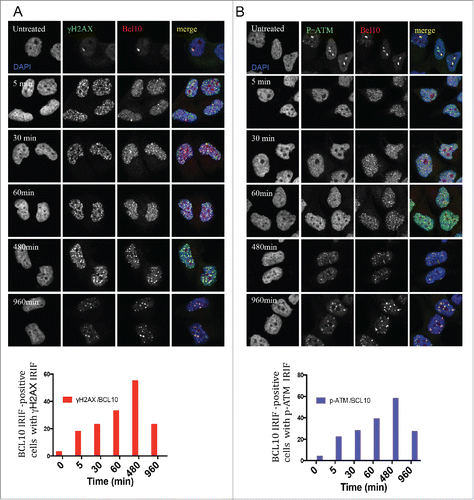 Figure 2. Kinetics of DNA damage-induced BCL10 foci formation. Immunodetection of BCL10 and γ-H2AX or p-ATM (S1981) at the indicated time points after IR (2 Gy) irradiation. Quantification of the average number of IR-induced BCL10/γ-H2AX or BCL10/p-ATM foci per cells is shown on the bottom. (A) BCL10/γ-H2AX. (B) BCL10/p-ATM.