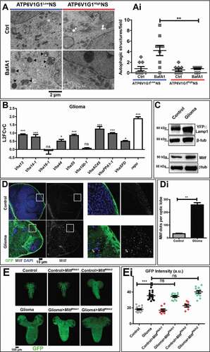 Figure 2. Autophagy in NS and characterization of the lysosomal compartment during gliomagenesis. (A) Representative EM images of NS treated with vehicle (Ctrl) and BafA1. ATP6V1G1High and ATP6V1G1Low NS show different accumulation of autophagic organelles (arrowheads) upon treatment. (Ai) Quantification of autophagic structures confirms that BafA1 causes accumulation of aberrant organelles only in ATP6V1G1Low NS. Data represent the mean ± S.D. and P‐value is obtained by one-way ANOVA, Kruskal Wallis test with Dunn’s Multiple Comparison. (B) qPCR analysis of the indicated V-ATPase subunits and of repo in fly glioma cells relative to control. mRNA expression levels confirm the upregulation of the V-ATPase subunits in fly gliomas. Data are expressed as L2FCvC. Bars, mean ± S.D. and P‐values are determined by two-way ANOVA with Bonferroni correction. (C) Western blot showing expression of YFP::Lamp1 (top) and Mitf (bottom). In gliomas, levels of both proteins are increased compared to controls. βtub is used as a loading control. (D) Single medial confocal sections of third instar larval brains. Nuclei were stained with DAPI, glial cell membranes with anti-GFP. Mitf is heavily accumulated in glioma compared to control optic lobes (quantified in Di). Data represent the mean ± S.D. and P‐values are determined by Mann-Whitney test. Mitf accumulation can be better appreciated in higher magnifications of insets. Notice that in gliomas, Mitf is almost exclusively in the cytoplasm, not in nuclei (insets). (E) Single medial confocal section of whole CNS of third instar larvae. Dorsal view, anterior up. Larval brains carrying gliomas in which Mitf has been downregulated show similar growth to gliomas(Quantified in Ei). Mean ± SEM and P‐values are determined by one-way ANOVA, Kruskal Wallis test with Dunn’s Multiple Comparison