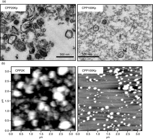 Fig. 2.  Transmission electron microscopy (TEM) and atomic force microscopy (AFM) analysis of platelet membrane vesicles (PMVs) in cryopreserved PLTs (CPPs). (a) Transmission electron microscopy (TEM) of PMVs in pellet of 20,000 g spun CPP2K (CPP20Kp) and 100,000 g spun CPP20K (CPP100Kp). (b) AFM analysis of PMVs in supernatant of 2,600 g spun CPP (CPP2K) and pellet of 100,000 g spun CPP20K (CPP100Kp).