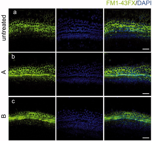 Figure 6. The new compounds do not interfere with FM1-43FX uptake. Compound A and B did not change the uptake of FM1-43FX in the organ of Corti (b, c) compared with the untreated group (a) indicating that HC functions were not affected by exposure to the new compounds. Confocal images were taken from the middle turn of each group. The green fluorescence represents the FM1-43FX signal. Scale bar =20 μm.