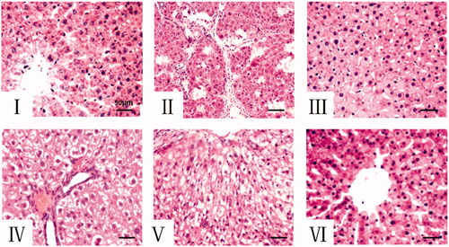 Figure 2. The histopathological examination by H&E (200 ×). (A): Control group, (B): Model group, (C): MET 0.2 g/kg group, (D): Cs 0.5 g/kg group, (E): Cs 1 g/kg group. (F): Cs 2 g/kg group. Cs: Cassia semen, MET: Metformin.