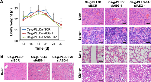 Figure S7 (A) Body weight of the mice in all groups. (B) Representative photographs of the heart, liver, spleen, lung, and kidney sections in all groups by H&E staining (×400 magnification). Scale bar 100 μm.Abbreviations: FA, folic acid; PLLD, poly (L-lysine) dendrons; AEG-1, astrocyte elevated gene-1; Cs-g-PLLD-FA, a novel nanoscale polysaccharide derivative prepared by click conjugation of azido-modified chitosan with propargyl focal point PLLD and subsequent coupling with FA; siSCR, scrambled small interfering RNA.