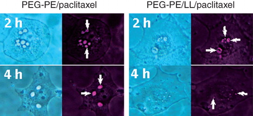 Figure 6. Microscopy of BT-20 cells incubated with PEG-PE/ paclitaxel micelles and PEG-PE/LL/paclitaxel micelles for 2 and 4 h. Bright-field (left images in each pair) and fluorescence (right images in each pair). Arrows indicate fluorescent endosomes in cells incubated with PEG-PE/paclitaxel micelles for 2 h; partially degraded endosomes in cells incubated with PEG-PE/LL/paclitaxel micelles for 2 h; punctuate fluorescent structures in cells incubated with PEG-PE/LL/paclitaxel micelles for 4 h; larger (fused) endosomes in cells incubated with PEG-PE/paclitaxel micelles for 4 h. Modified from Torchilin (Citation2005a).
