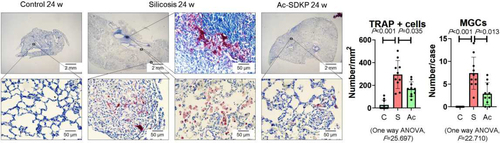Figure 1 Ac-SDKP reduces formation of TRAP-positive macrophages. TRAP staining, Bar=2 mm and 500 μm, Data are presented as the mean ± SD. n = 10 per group.