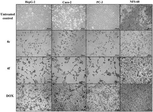 Figure 6. Morphological alterations of the most active compounds (0.06 µM)-treated cancer cells lines in comparison with the untreated cancer cells after 72 h incubation.