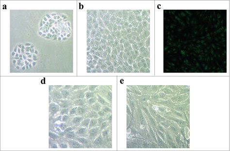 Figure 1. The isolation, culture and identification of porcine vascular endothelial cells. (a) The morphology of porcine vascular endothelial cells after two days cultured. (b) The morphology of cells after eight days cultured. (c) The vascular endothelial cells were identified by immunofluorescent staining. (d) The morphology of vascular endothelial cells without ApoCIII treatment. (e) The morphology of vascular endothelial cells changed after ApoCIII treatment.