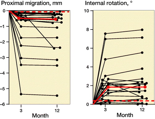 Figure 3. Individual patient values for subsidence and internal rotation of the neck at 3 and 12 months. The median values are shown in red and the precision limit is shown with a dashed red line.