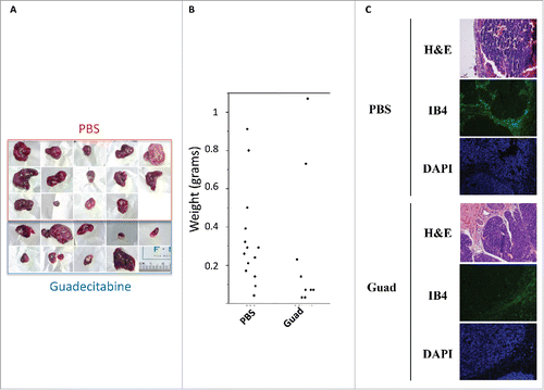 Figure 2. Guadecitabine (Guad) prevents tumor growth in a HepG2 xenograft model. A. Pictures of explanted HepG2 tumors from PBS- and guadecitabine-injected immunocompromised mice, next to a ruler. B. Tumor growth in balb/c mice inoculated with HepG2 cells. The control group (n = 14) was injected with PBS while the experimental group (n = 14) was injected daily with 2 mg/kg guadecitabine from day 1 to 3 post-inoculation. Animals were sacrificed after 38 d, tumors were excised, and tumor, and volume/weight were assessed by means of a caliper and a precision scale, respectively. C. Tumors as in A-B were processed for H&E staining or for immunofluorescence with antibody against IsolectinB4 (IB4). For IF staining, nuclei were counterstained with DAPI.