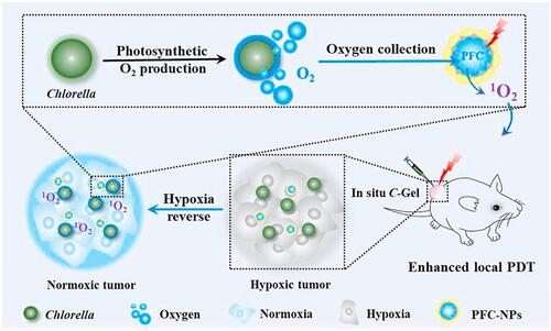 Figure 3 Schematic diagram of the PFC hybrid material. Oxygen generated by Chlorella can be collected by PFC to maintain a high concentration around the photosensitizer, which can continuously alleviate the hypoxic conditions of tumor tissues. The relief of tumor hypoxia can enhance the PDT effect mediated by singlet oxygen. J Biomaterials. Feb 2021;269:120621. Copyright (2020), Elsevier. Reproduced from Wang H, Guo Y, Wang C, et al. Light-controlled oxygen production and collection for sustainable photodynamic therapy in tumor hypoxia. 605Biomaterials. 2021;269:120621. doi:10.1016/j.biomaterials.2020.120621. Copyright 2021, with permission from Elsevier.Citation36