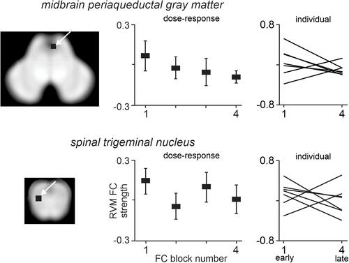 Figure 4 Plots of mean±SEM rostral ventromedial medulla (RVM) functional connectivity (FC) strength during four blocks evenly spaced during the 12-minute scan in the 7 stable pain subjects. The region of the midbrain periaqueductal gray matter and spinal trigeminal nucleus that were examined are indicated by the black shading and arrow on the overlays to the left.