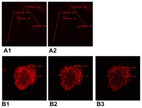 Figure 3 Confocal laser scanning microscopy of cellular incorporation and release of doxorubicin in A549 multicellular spheroids. (A1) A549 spheroid cells incubated in free doxorubicin for 4 hours. (A2) Free doxorubicin released from the spheroid for one hour. (B1) A549 spheroid cells incubated in composite doxorubicin-loaded micelles with the same doxorubicin densities for 4 hours. (B2) Composite doxorubicin-loaded micelles released from the spheroid for one hour. (B3) Composite doxorubicin-loaded micelles released from the spheroid for 2.5 hours.