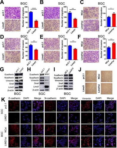 Figure 3 LIMD1 inhibits cell migration and invasion in GC cells.Notes: (A–C). Cell migration assays of BGC823 and SGC7901 cells transfected with LIMD1 overexpression vector (A and B) and LIMD1si (C) are shown (40×). (D–F) Cell invasion assays of BGC823 and SGC7901 cells transfected with LIMD1 overexpression vector (D and E) and LIMD1si (F) are shown (40×). (G–I) LIMD1 alters EMT markers. Western blot analysis with the indicated antibodies in LIMD1-overexpressing (G and H) and LIMD1-downexpressing (I) GC cells is depicted. Cell morphology of BGC823 cells with altered LIMD1 is depicted in (J) (10×). Immunofluorescence assay of EMT markers, including E-cadherin, N-cadherin, and Vimentin, is shown in (K) (40×). *P<0.05; **P<0.01; ****P<0.0001. LIMD1, LIMD1 overexpression vector; pc3.1, empty vector.Abbreviations: EMT, epithelial to mesenchymal transition; GC, gastric cancer; LIMD1si, LIMD1-siRNA; NCsi, negative control siRNA.