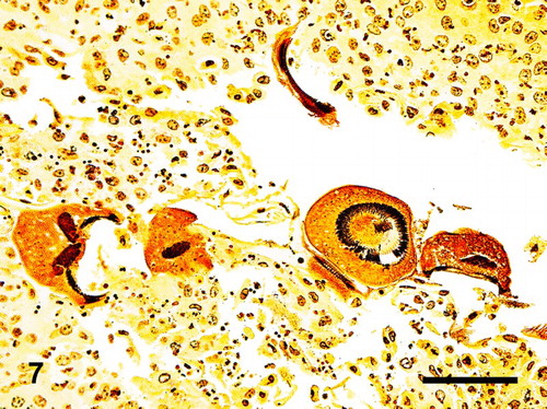 Figure 7. Phallus; goose, case no. 1. The denticles of the trichodinids are highlighted by the silver staining. Hurtado's Leptospira silver. Bar = 70 µm.