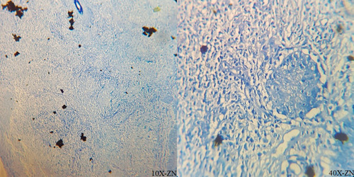 Figure 3 The Ziehl–Neelsen stained histopathological assessment (Magnifications: 10× and 40×).