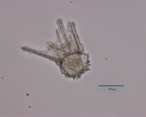 Figure 2. GAMB10-treated (0.56 mg L–1) Evechinus chloroticus embryo 96 h post-fertilisation showing abnormal development with the growth of an additional arm.