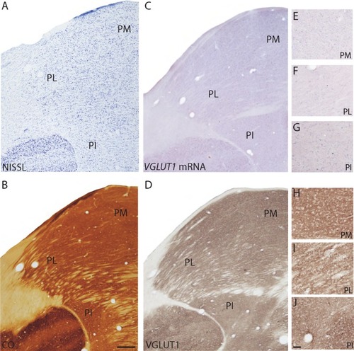 Figure 2 Coronal sections through the pulvinar complex stained for (A) Nissl, (B) CO, (C) VGLUT1 mRNA, and (D) VGLUT1 protein. (E–J) High magnification images of subdivisions of the pulvinar complex stained for (E–G) VGLUT1 mRNA and (H–J) VGLUT1 protein.