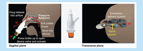 Figure 2. Mechanism of exhalation delivery system.Reproduced with permission from [Citation12].