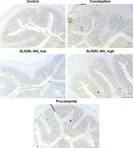 Figure 3 Effect of SLIGRL-NH2 on the expression of ANO1 in colons of loperamide-induced constipated rats.