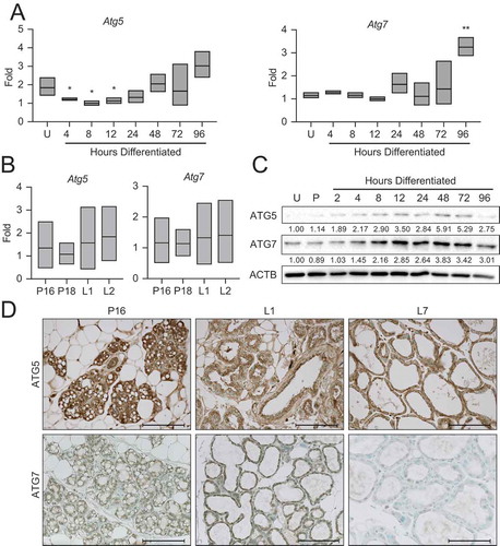 Figure 5. Expression of autophagy factors during HC11 cell differentiation and mammary gland development. (A) Atg5 and Atg7 expression across differentiation in HC11 cells and (B) at pregnancy days 16 and 18 (P16, P18) and lactation days 1 and 2 (L1, L2) in the mouse mammary gland. RNA was collected from three mice per developmental time point. (C) Expression levels of ATG5 and ATG7 across differentiation in HC11 cells. Levels of ATG5 and ATG7 are indicated below each lane after normalization to ACTB. The undifferentiated time point was set to 1.00, and all other time points are presented relative to 1.00. (D) ATG5 and ATG7 expression at P16, L1, and L7 in the mouse mammary gland. Two mice were evaluated for each time point, and two sections from each mouse were stained for comparisons. U: undifferentiated; P: 24 h primed; h: hours differentiated. Scale bars: 100 μm. Data are presented as mean ± standard deviation. Statistical significance was evaluated with multiple student t-tests relative to the undifferentiated time point (U). *p < 0.05, **p < 0.01