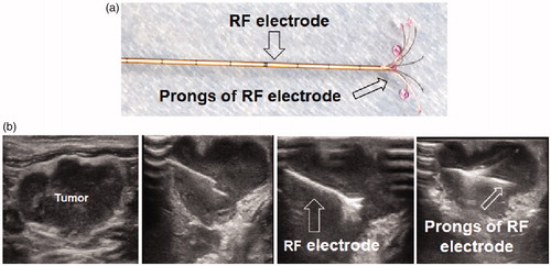 Figure 4. Ultrasound imaging-guided intratumoral gene therapy of rat orthotopic ovarian cancer. (a) A multipolar RF/perfusion electrode was used to deliver RFH and HSV-TK/lentiviral particles simultaneously into the tumor. (b) Under ultrasound imaging guidance, the RF/perfusion electrode was precisely positioned into the ovarian tumor.