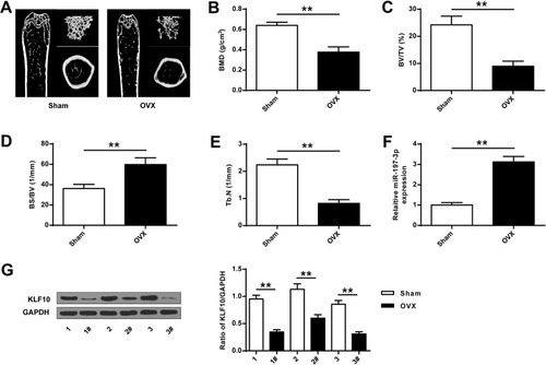 Figure 1 MiR-197-3p and KLF10 expression in ovariectomized osteoporosis rat models. (A) representative micro-CT images of the right femur. (B) Bone mineral density (BMD) of femoral tissue. (C) Micro-CT analysis of TV/TV in OVX and Sham groups. (D) Micro-CT analysis of BS/BV in OVX and Sham rats. (E) Micro-CT analysis of Tb.N in OVX and Sham groups. (F). MiR-197-3p expression in femoral tissue of OVX and Sham groups. (G) Protein expression of KLF10 in femoral tissue of OVX and Sham groups. N = 3. ** P <0.01.