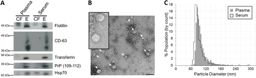 Fig. 3.  Characterization of plasma and serum exosomes isolated by differential ultracentrifugation. (A) Western immunoblotting of exosomal markers flotillin, CD-63, transferrin, PrP (109–112) and Hsp70 in cell-free (CF) and exosomal (E) samples in plasma and serum. (B) Plasma and serum exosomes were analysed under electron microscopy which displayed the same morphology. Plasma exosomes are shown here. Insert is a larger magnification of the exosomal vesicles. Bar = 100 nm (C) Size distribution of exosomes analysed by the qNano particle counter. Experiments shown here are representative of samples collected from 1 volunteer.