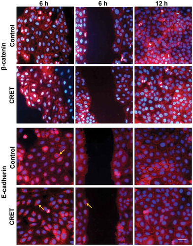 Figure 6. Immunofluorescence expression of β-catenin and E-cadherin in keratinocytes. Monolayers (side columns) at 6 h or 12 h of CRET or sham treatment (Control), and on the gap edges (central column) at 6 h. Representative merged images. Red: β-catenin and E-cadherin labeling. Blue: nuclei. Bar: 20 µm. Brightness and contrast adjustments were applied to the whole of each image using Photoshop software. The adjustments in the micrographs of the treated samples were identical to those in their controls. Arrows show dotted labeling of E-Cadherin at perinuclear locations