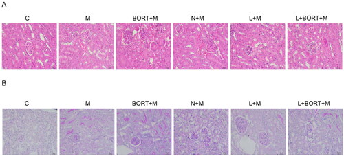 Figure 4. Liraglutide reduces kidney pathological damage and glycogen deposition in high-fat diet-induced mice. (A) H&E staining to observe the pathological damage of mouse kidney tissues in each group; (B) PAS staining to observe the glycogen deposition of mouse kidney tissues in each group. Scale bar = 20 μm. H&E: hematoxylin–eosin; PAS: periodic acid-Schiff.