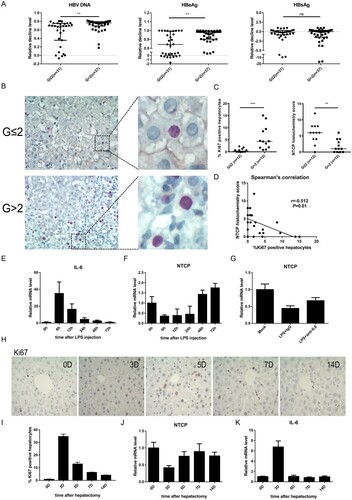 Figure 4. Down-regulation of NTCP in the liver of CHB patients with higher inflammatory activity and the probable regulatory mechanism. (A) Decline degrees of viral markers of CHB patients. Data calculated as the level before treatment minus the 6-month level after treatment and then divided by the level before treatment each patient. (B) Immunohistochemical double staining of NTCP (brown) and Ki67 (red) of liver biopsy specimens. (C) The percentage of Ki67-positive hepatocytes (calculated by the average of five counted fields each tissue) and NTCP histochemistry scores (calculated by positive hepatocyte ratio multiplying staining intensity). (D) Spearman's correlation of NTCP histochemistry scores and the percentage of Ki67-positive hepatocytes. (E) Real-time RT-PCR assay analysed mouse IL-6 mRNA expression after injection of LPS. (F and G) Real-time RT-PCR assay analysed mouse NTCP mRNA expression after injection of LPS (F) and after injection of LPS together with neutralizing serum IL-6 with IL-6 antibodies (G). (H) Ki67 immunohistochemical staining of mouse liver slices per time point after 70% partial hepatectomy. (I) The proliferation index was set up by counting the percentage of Ki67-positive hepatocytes on five fields per mouse and time point. (J and K) mRNA level of NTCP (J) and IL-6 (K) after mouse 70% partial hepatectomy at the indicated time points. Data were collected from three to five mice each time point. (**P < 0.01; ***P < 0.001; ns: not significant).