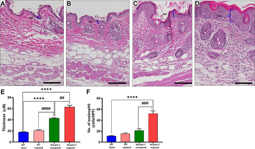 Figure 6 Intranasal Aspergillus and OVA exposure led to severe eosinophilic skin inflammation. Epithelial thickness was presented in H&E-stained section (10x objective) in (A) WT naïve, (B) WT exposed, (C) Sharpin-/- unexposed and (D) Sharpin-/- exposed groups, respectively. The blue line indicates the boundary line between the epidermis and the dermis. (E) Measurement of epidermal thickness (F) represents average number of Eosinophils per HPF counted in five random sites. Results are expressed as the mean ± SD; n=5–7 mice/group. ****p<0.0001 vs WT naïve; #### p<0.0001, ### p<0.001, ##p<0.01 vs Sharpin-/- unexposed. Scale-100µM.