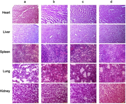 Figure S2 HE staining of organs tissues (heart, liver, spleen, lung, and kidney) in TNBC cancer-bearing mice. (a) Physiological saline; (b) Functional miRNA liposomes; (c) Functional vinorelbine liposomes; (d) Functional vinorelbine liposomes plus functional miRNA liposomes. The results reveal that, after treatments, heart, liver, spleen, lung, and kidney tissues in the cancer-bearing rats have no obvious histopathological abnormalities or lesions as compared with those in the healthy rats.