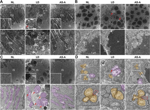 Figure 6 AS-A attenuates bright light-induced ultrastructural impairment in photoreceptors. Eyes were enucleated from the indicated treatment groups 1 d after bright light exposure, followed by processing for TEM examination. (A–D) Representative TEM micrographs showing the ultrastructural features of the OS and connecting cilium (A), ONL (B), IS (C) as well as mitochondria and synaptic ribbons in the OPL (D). Mitochondria were highlighted in purple (C and D) and the dendritic tips of bipolar cells and horizontal cells were highlighted in Orange (D). Red arrows point to impaired OS (A), nuclei characterized by karyolysis (B) and swollen mitochondria (C and D). White arrows point to impaired nuclear envelope (B). Red squares frame synaptic ribbons in the photoreceptor synaptic terminals (D). Scale bar in a and b: top panel, 2 μm; bottom panel, 1 μm. Scale bar in c: top panel, 2 μm; bottom panel, 500 nm. Scale bar in d: 500 nm.