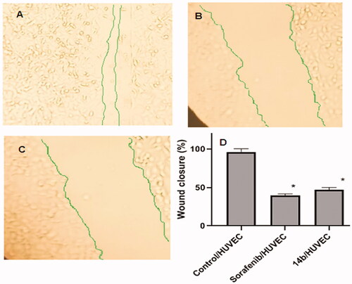 Figure 5. Effects of compound 14b on endothelial cell migration in HUVEC cells compared to sorafenib. (A) Control/HUVECs, (B) HUVECs were treated with compound 14b for 72 h. (C) HUVECs were treated with sorafenib for 72 h. (D) Represents the graphical illustration for % of wound closure in control, sorafenib and 14b treated cells. Data are represented as mean ± SEM of three different experiments. *Significant from the control group at p < 0.001.