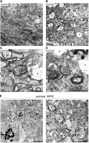 FIG 3 Electron microscopic analyses for autophagosomal structures and WIPI2 localization under hyperosmotic stress. (A to D) Wild-type MEFs were cultured in DMEM with (B to D) or without (A) 0.8 M sucrose for 1 h and then fixed for EM. The boxed region in panel B is shown enlarged in panel C. (E) Wild-type MEFs were cultured in DMEM with 0.8 M sucrose for 30 min and then fixed with 4% paraformaldehyde alone (left) or 4% paraformaldehyde-0.01% glutaraldehyde (right) for immuno-EM using anti-WIPI2 antibody. Note that after hyperosmotic stress, large endosome-like structures (asterisks), lysosome-like profiles (L), and degenerated mitochondria (M) increased. m, mitochondria in the control; N, nucleus. Bars, 0.5 μm.