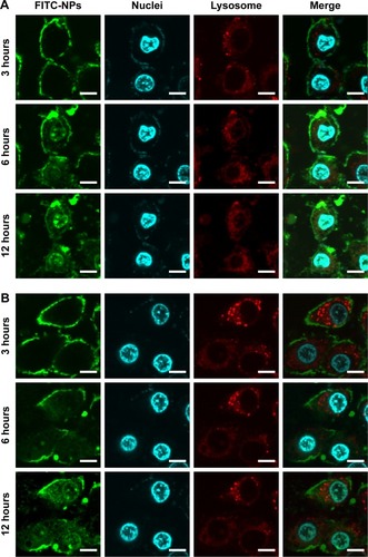 Figure 3 The uptake of FITC-labeled chitosan–protamine NPs (A) and FITC-labeled chitosan NPs (B) in HeLa cells after incubation for 12 hours with chitosan NPs and chitosan–protamine NPs. FITC as a green fluorescent marker was encapsulated in NPs to indicate the intracellular location of NPs; the nucleus was stained with Hoechst (blue) and the lysosome was stained with Lyso-Tracker Red DND-99 (red). The scale bar is 50 μm.Abbreviations: FITC, fluorescein isothiocyanate; NP, nanoparticle.