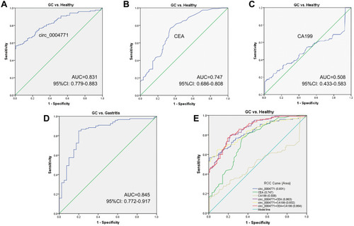 Figure 4 Potential of circ_0004771 to be a diagnostic biomarker. (A) ROC curve analysis of plasma circ_0004771 for discriminating primary GC patients and healthy donors (AUC=0.831). (B) The diagnostic efficacy of CEA (AUC=0.747). (C) The diagnostic efficacy of CA199 (AUC=0.508) (D) ROC curve analysis of plasma circ_0004771 for discriminating primary GC patients and gastritis patients (AUC=0.845). (E) Combined diagnostic efficacy of plasma circ_0004771, CEA and CA199 exerted the best diagnostic efficacy in distinguishing GC patients and healthy donors (AUC=0.864).