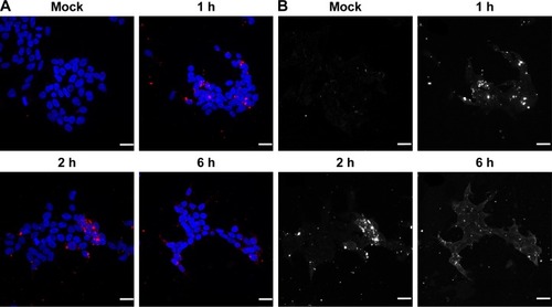 Figure 7 HEK293T cells were transfected with Cy3-labeled siRNA together with reference Citation14 and were analyzed at 1, 2, and 6 h after transfection using confocal microscopy (A and B).Notes: Grayscale images are shown in part B. Scale bars, 25 μm. Composition of reference Citation14: 200 mg stearic acid, 300 mg cholesteryl oleate, 600 mg octadecylamine, 100 mg poloxamer 188.