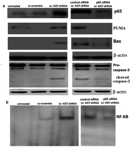 Figure 2. Targeting XIST induces p65-dependent PUMA expression. U2OS cells were transfected with Lv-shRNA or Lv-scramble for 72 h, or p65 siRNA (control siRNA) and Lv-XIST shRNA were co-transfected into U2OS cells for 72 h.A, P65,PUMA, bax, cleaved-caspase-3 were detected by Western blot assay; B, NF-KB activity was detected by EMSA assay. β-actin was used for normalization.