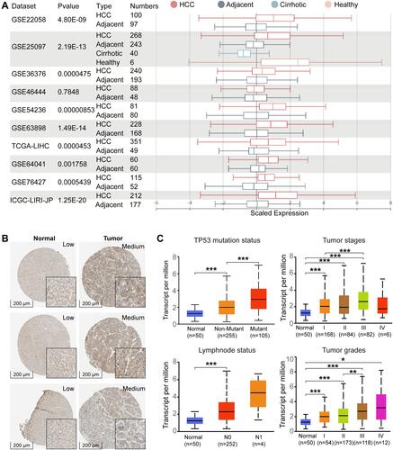 Figure 1 The expression level of QSER1 in HCC. (A) The mRNA expression of QSER1 in 9 of 10 clinical cohorts was significantly different between HCC and normal liver tissues; (B) Representative IHC images from the HPA database; (C) The expression level of QSER1 in different subgroups of HCC. The Student’s t-test, *p< 0.05; **p< 0.01; ***p< 0.001.