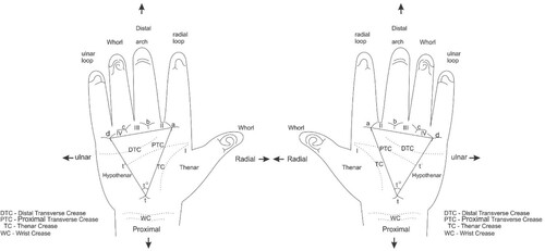 Figure 2. A diagram showing the palmar surface and method of determining the atd angle of the right and left hands. Demonstrated are the four digital triradii (a, b, c, d) located in proximal relation to the bases of the digits I, II, III, and IV (index finger to the little finger, respectively). The lines drawn from the distal ‘t’ triradius to the medial ‘a’ triradius and the lateral ‘d’ triradius form the atd angle (t°). Adapted from Singh et al. (Citation2016).