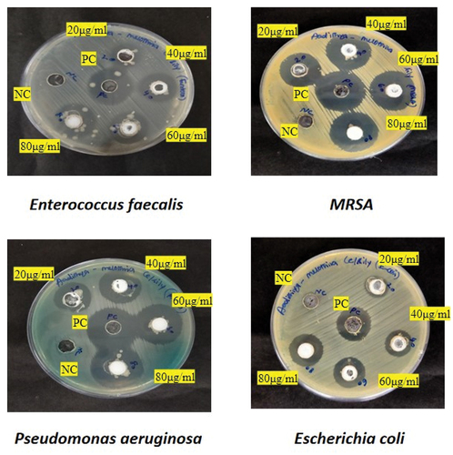 Figure 7. Antibacterial activity of Ce-Sil NPs.