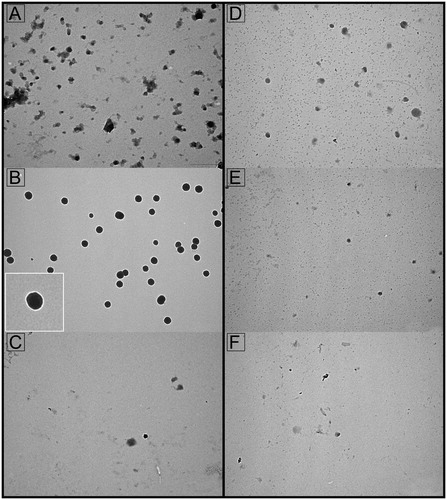Figure 4. Transmission electron microscopy of seminal prostasomes from oligozoospermic men separated by lectin-affinity chromatography. Micrographs of vesicles (70–120 nm) in a concanavalin A (Con A)-non-bound fraction (A) and vesicles (80–170 nm) in a Con A-bound fraction (B). The insert shows the typical cup-shape appearance enlarged. Micrographs of vesicles (70–130 nm) in a wheat germ agglutinin (WGA)-non-bound fraction (D) and vesicles (50–100 nm) in a WGA-bound fraction (E). Vesicles in the high-pH-eluted fraction from Con A column (C) and low-pH-eluted fraction from WGA column (F) were scarce.