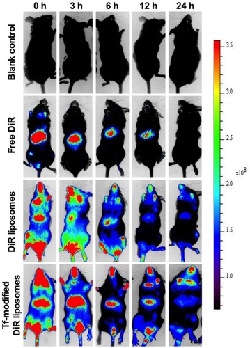 Figure 6 Real-time imaging observation after intravenous administration of varying liposomal formulations in APP/PS-1 mice (n=3).